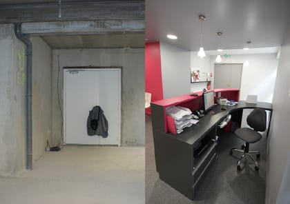 Aïe dentiste — avant ou pendant les travaux