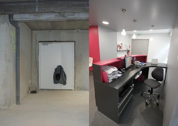 Aïe dentiste — avant ou pendant les travaux